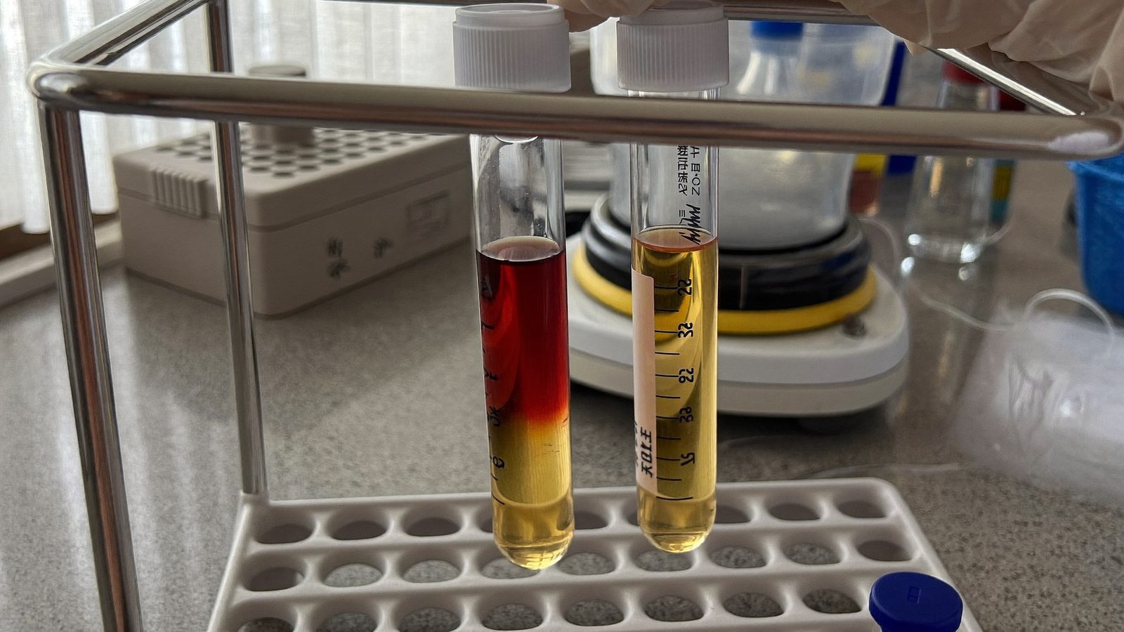 Centrifuged blood tubes with a golden plasma layer in a rack beside a benchtop centrifuge