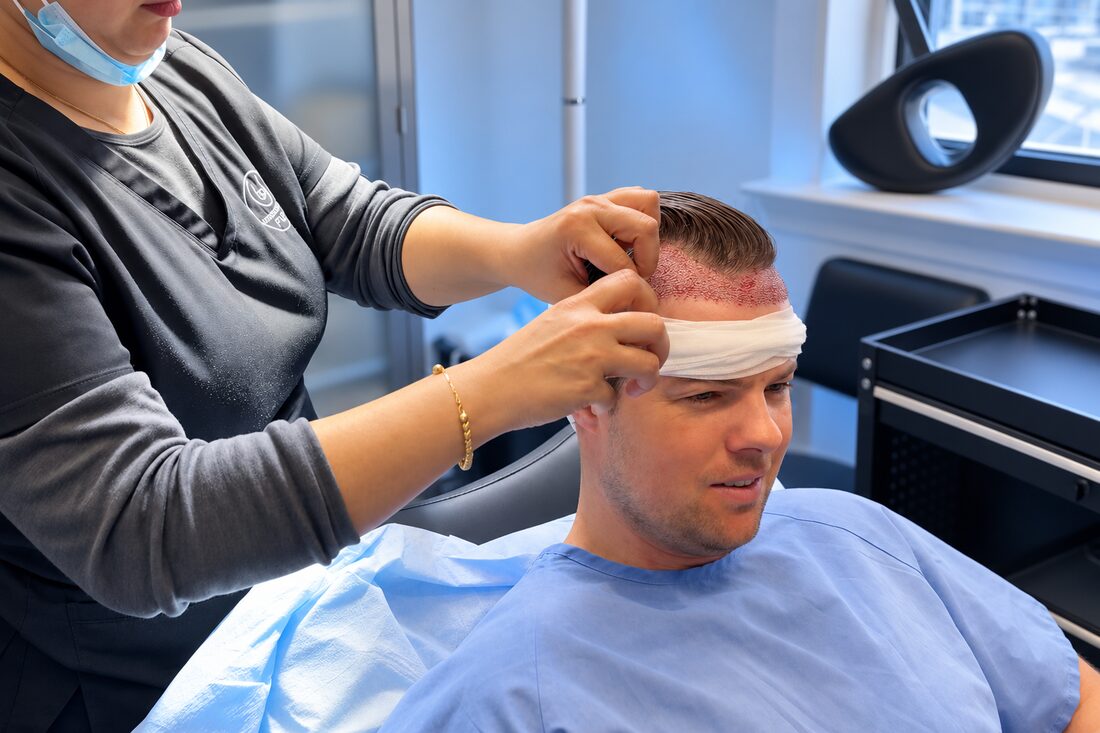 FUE hair transplant at Nova Medical Long Island